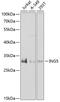 Inhibitor of growth protein 5 antibody, 22-837, ProSci, Western Blot image 
