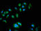 ATPase H+ Transporting V0 Subunit A1 antibody, orb400708, Biorbyt, Immunocytochemistry image 