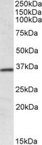 Homeobox protein Hox-A4 antibody, STJ72242, St John