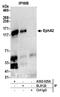 Ephrin type-A receptor 2 antibody, A302-025A, Bethyl Labs, Immunoprecipitation image 