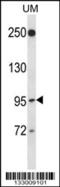 Ral guanine nucleotide dissociation stimulator-like 2 antibody, 57-057, ProSci, Western Blot image 