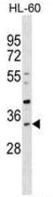 Sulfotransferase Family 1B Member 1 antibody, AP54103PU-N, Origene, Western Blot image 