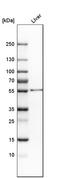 Aldehyde Dehydrogenase 2 Family Member antibody, HPA051065, Atlas Antibodies, Western Blot image 