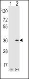 Sulfotransferase Family 1A Member 1 antibody, 61-426, ProSci, Western Blot image 
