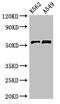 CUGBP Elav-Like Family Member 2 antibody, CSB-PA006217LA01HU, Cusabio, Western Blot image 