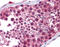 Histone Deacetylase 6 antibody, ARP32309_P050, Aviva Systems Biology, Immunohistochemistry paraffin image 