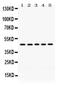 Phosphoglycerate kinase antibody, PB9774, Boster Biological Technology, Western Blot image 