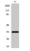 ELOVL Fatty Acid Elongase 6 antibody, STJ92905, St John