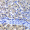 Proteasome 26S Subunit, Non-ATPase 8 antibody, 22-585, ProSci, Immunohistochemistry frozen image 