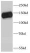 Platelet glycoprotein Ib alpha chain antibody, FNab01479, FineTest, Western Blot image 