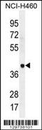 Leucine Rich Repeat Containing 38 antibody, 56-103, ProSci, Western Blot image 