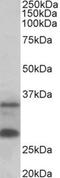 U6 SnRNA Biogenesis Phosphodiesterase 1 antibody, NBP1-97768, Novus Biologicals, Western Blot image 