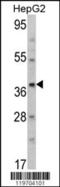 Aminomethyltransferase antibody, MBS9211959, MyBioSource, Western Blot image 