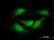 Nuclear receptor subfamily 0 group B member 1 antibody, LS-C196629, Lifespan Biosciences, Immunofluorescence image 