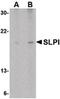 Secretory Leukocyte Peptidase Inhibitor antibody, LS-C34710, Lifespan Biosciences, Western Blot image 