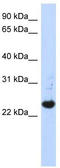Spermatogenesis And Centriole Associated 1 Like antibody, TA338948, Origene, Western Blot image 
