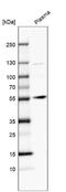 Angiopoietin 1 antibody, NBP1-90169, Novus Biologicals, Western Blot image 