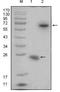 R-Spondin 1 antibody, NBP1-28867, Novus Biologicals, Western Blot image 