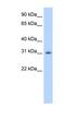 Apolipoprotein B MRNA Editing Enzyme Catalytic Subunit 2 antibody, NBP1-57469, Novus Biologicals, Western Blot image 