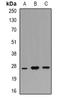 POU domain class 2-associating factor 1 antibody, orb381971, Biorbyt, Western Blot image 
