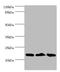 NADH:Ubiquinone Oxidoreductase Subunit B5 antibody, A50398-100, Epigentek, Western Blot image 