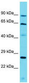 Telomere Repeat Binding Bouquet Formation Protein 1 antibody, TA334841, Origene, Western Blot image 