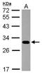 Proteasome 20S beta7 subunit antibody, NBP2-19954, Novus Biologicals, Western Blot image 