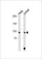 Signal Transducer And Activator Of Transcription 1 antibody, LS-C156164, Lifespan Biosciences, Western Blot image 