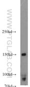 CD11C antibody, 17342-1-AP, Proteintech Group, Western Blot image 