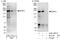 Mitogen-Activated Protein Kinase Kinase Kinase 1 antibody, A302-395A, Bethyl Labs, Immunoprecipitation image 