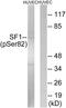 Splicing Factor 1 antibody, AP55704PU-N, Origene, Western Blot image 