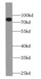Zinc finger protein GLI2 antibody, FNab03477, FineTest, Western Blot image 