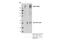 ATP Binding Cassette Subfamily C Member 1 antibody, 72202S, Cell Signaling Technology, Immunoprecipitation image 
