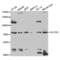 Solute Carrier Family 3 Member 1 antibody, abx004215, Abbexa, Western Blot image 