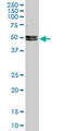 NOVA Alternative Splicing Regulator 1 antibody, LS-C139334, Lifespan Biosciences, Western Blot image 