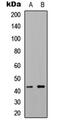 5-Hydroxytryptamine Receptor 1F antibody, abx133117, Abbexa, Western Blot image 