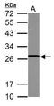 Glutathione S-transferase Mu 5 antibody, GTX103998, GeneTex, Western Blot image 