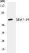 Matrix Metallopeptidase 19 antibody, EKC1379, Boster Biological Technology, Western Blot image 