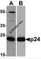 HIV-1 Gag polyprotein antibody, PM-6585, ProSci, Western Blot image 