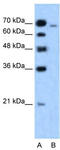 L Afadin antibody, TA335978, Origene, Western Blot image 