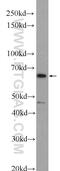 DFS70 antibody, 25504-1-AP, Proteintech Group, Western Blot image 