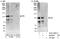 Progesterone Receptor antibody, A301-200A, Bethyl Labs, Immunoprecipitation image 