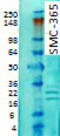 Potassium Voltage-Gated Channel Interacting Protein 1 antibody, TA326562, Origene, Western Blot image 