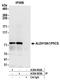 Aldehyde Dehydrogenase 18 Family Member A1 antibody, A304-803A, Bethyl Labs, Immunoprecipitation image 