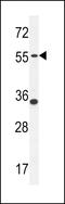 Phosphodiesterase 12 antibody, LS-C163466, Lifespan Biosciences, Western Blot image 