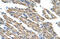 Kelch Like ECH Associated Protein 1 antibody, ARP38981_P050, Aviva Systems Biology, Immunohistochemistry paraffin image 