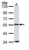 Septin 11 antibody, PA5-29435, Invitrogen Antibodies, Western Blot image 