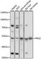 Protein Z, Vitamin K Dependent Plasma Glycoprotein antibody, A06491-1, Boster Biological Technology, Western Blot image 