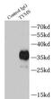 Thymidylate Synthetase antibody, FNab08681, FineTest, Immunoprecipitation image 
