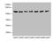 Cholinergic Receptor Nicotinic Alpha 9 Subunit antibody, LS-C675536, Lifespan Biosciences, Western Blot image 